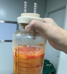 梅州水动力吸脂手术要做多久？